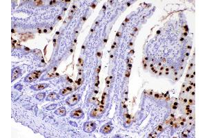 IHC analysis of MUC2 using anti-MUC2 antibody . (MUC2 Antikörper)