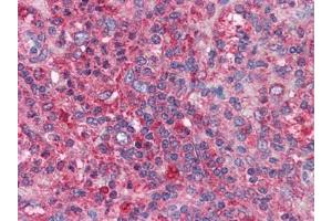 Human Spleen: Formalin-Fixed, Paraffin-Embedded (FFPE) (BIRC3 Antikörper)