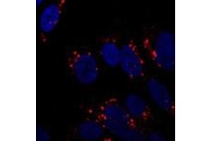 Immunofluorescent staining of ATG5 on SH-SY5Y cells using ATG5 polyclonal antibody  at 1 : 250. (ATG5 Antikörper  (AA 1-50))