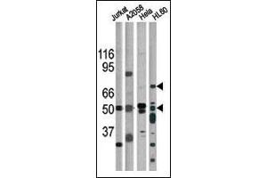 The anti-Phospho-CHK1- Pab (ABIN391324 and ABIN2841354) is used in Western blot for detection in, from left to right, Jurkat, , Hela, and HL60 tissue lysates. (CHEK1 Antikörper  (pSer317))