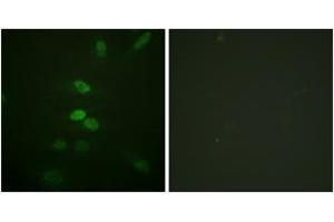 Immunofluorescence analysis of HeLa cells, using CDC25B (Ab-353) Antibody. (CDC25B Antikörper  (AA 319-368))