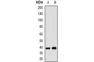 Western blot analysis of WNT7B expression in A549 (A), HepG2 (B) whole cell lysates. (WNT7B Antikörper)