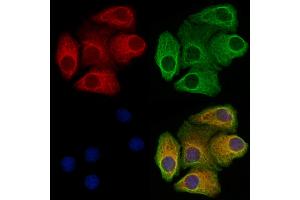 ABIN6265294 and ABIN6273324 staining Hela cells by IF/ICC. (SRPX2 Antikörper  (Internal Region))