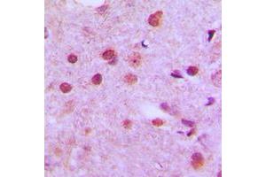 Immunohistochemical analysis of NFYC staining in human brain formalin fixed paraffin embedded tissue section. (NFYC Antikörper  (N-Term))