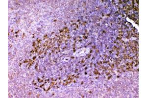 Immunohistochemistry (IHC) image for anti-Adenosine Deaminase (ADA) (AA 2-241) antibody (ABIN5692791)