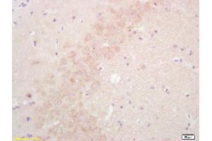 Formalin-fixed and paraffin embedded rat brain labeled with Rabbit Anti SULT1E1/Estrogen Sulfotranferase Polyclonal Antibody, Unconjugated (ABIN671106) at 1:200 followed by conjugation to the secondary antibody and DAB staining