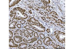 IHC analysis of RCC1 using anti-RCC1 antibody (ABIN7600022).