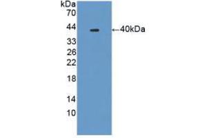 Western blot analysis of recombinant Mouse PLA2R1. (PLA2R1 Antikörper  (AA 1418-1487))