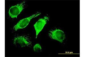 Immunofluorescence of purified MaxPab antibody to DNAJA3 on HeLa cell. (DNAJA3 Antikörper  (AA 1-480))
