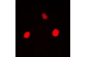 Immunofluorescent analysis of Hexokinase 1 staining in HEK293T cells.
