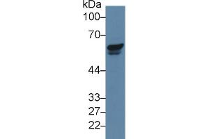 Western blot analysis of Human Jurkat cell lysate, using Human PAK2 Antibody (5 µg/ml) and HRP-conjugated Goat Anti-Rabbit antibody ( (PAK2 Antikörper  (AA 177-419))