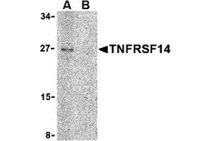 Western Blotting (WB) image for anti-Tumor Necrosis Factor Receptor Superfamily, Member 14 (TNFRSF14) (C-Term) antibody (ABIN1030760) (HVEM Antikörper  (C-Term))