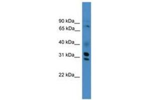 Image no. 1 for anti-GIPC PDZ Domain Containing Family, Member 3 (GIPC3) (AA 221-270) antibody (ABIN6745447) (GIPC3 Antikörper  (AA 221-270))