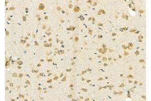 ABIN6257639 and ABIN6274782 at 1/100 staining Rat brain tissue by IHC-P.
