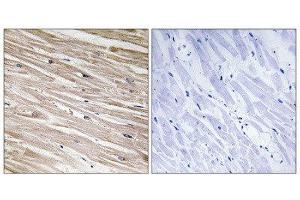 Immunohistochemistry (IHC) image for anti-phosphoprotein Enriched in Astrocytes 15 (PEA15) (pSer104) antibody (ABIN1847322) (PEA15 Antikörper  (pSer104))