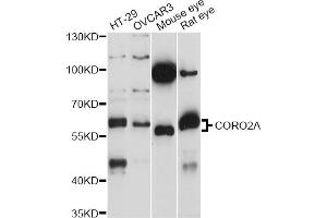 Western blot analysis of extracts of various cell lines, using CORO2A antibody (ABIN6293915) at 1:1000 dilution. (CORO2A Antikörper)