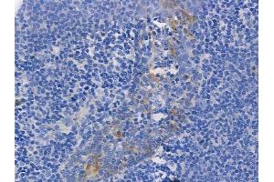 ABIN6255771 and ABIN6267262 at 1/100 staining human normal tonsil tissue by IHC-P. (EGFR Antikörper  (pTyr1068, pTyr1092))