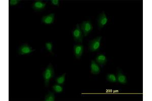 Immunofluorescence of monoclonal antibody to ARID1B on HeLa cell. (ARID1B Antikörper  (AA 1364-1460))