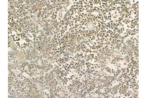 ABIN6264533 and ABIN6276573 at 1/100 staining human pituitary adenoma by IHC-P. (PYCARD Antikörper  (N-Term))
