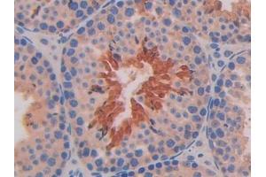Immunohistochemistry (IHC) image for anti-Interleukin 11 Receptor, alpha (IL11RA) (AA 194-329) antibody (ABIN7438169)
