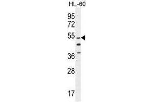 CO044 Antibody (C-term) western blot analysis in HL-60 cell line lysates (35µg/lane). (CO044 (AA 358-387), (C-Term) Antikörper)