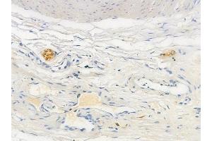 ABIN6256307 and ABIN6267423 at 1/100 staining human testicular cancer by IHC-P.