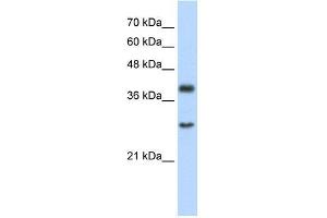 Human Jurkat; WB Suggested Anti-WDR39 Antibody Titration: 2. (CIAO1 Antikörper  (C-Term))