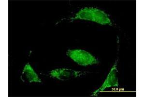 Immunofluorescence of purified MaxPab antibody to MCCC2 on HeLa cell. (MCCC2 Antikörper  (AA 1-563))