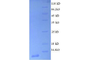50S Ribosomal Protein L30 (AA 1-59), (full length) protein (His tag)