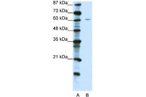 WB Suggested Anti-ZNF286 Antibody Titration:  1. (ZNF286A Antikörper  (C-Term))