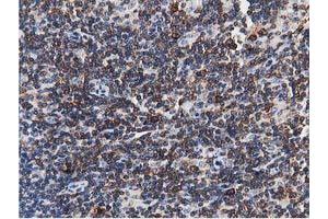 Image no. 9 for anti-Transforming, Acidic Coiled-Coil Containing Protein 3 (TACC3) antibody (ABIN1498095) (TACC3 Antikörper)