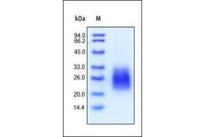 SDS-PAGE (SDS) image for Fms-Related tyrosine Kinase 3 Ligand (FLT3LG) (AA 27-185) protein (His tag) (ABIN2181110)