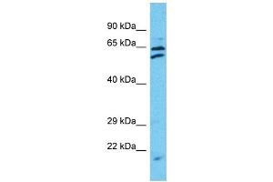 Western Blotting (WB) image for anti-Tetratricopeptide Repeat Domain 24 (TTC24) (C-Term) antibody (ABIN2791966) (TTC24 Antikörper  (C-Term))