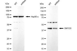 Western blotting analysis using SMYD3 antibody (ABIN7800322). (Rekombinanter SMYD3 Antikörper)