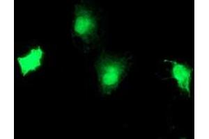 Anti-TBCC mouse monoclonal antibody (ABIN2455773) immunofluorescent staining of COS7 cells transiently transfected by pCMV6-ENTRY TBCC (RC203563). (TBCC Antikörper)