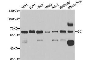 Western blot analysis of extracts of various cell lines, using GC antibody. (Gc Antikörper)