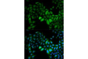 Immunofluorescence analysis of HeLa cells using TK1 antibody (ABIN5973268).