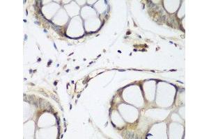Immunohistochemistry of paraffin-embedded Human gastric using TAZ Polyclonal Antibody at dilution of 1:200 (40x lens). (TAZ Antikörper)