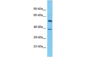 Host:  Rabbit  Target Name:  LUC7L3  Sample Type:  Pancreas Tumor lysates  Antibody Dilution:  1. (LUC7-Like 3 Antikörper  (Middle Region))
