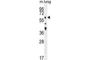 TGFBR2 Antibody (N-term) western blot analysis in mouse lung tissue lysates (35 µg/lane).