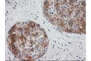 Image no. 7 for anti-BAI1-Associated Protein 2 (BAIAP2) antibody (ABIN1496805) (BAIAP2 Antikörper)