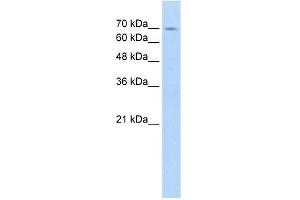WB Suggested Anti-FBXL5 Antibody Titration:  5. (FBXL5 Antikörper  (Middle Region))