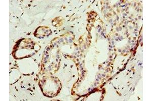 Immunohistochemistry (IHC) image for anti-Amyloid beta (A4) Precursor Protein-Binding, Family B, Member 1 Interacting Protein (APBB1IP) (AA 1-150) antibody (ABIN7144041)