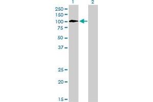 Western Blot analysis of TYRO3 expression in transfected 293T cell line by TYRO3 monoclonal antibody (M05), clone 4F6. (TYRO3 Antikörper  (AA 50-150))
