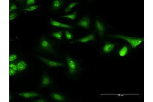 Immunofluorescence of monoclonal antibody to CAMLG on HeLa cell.