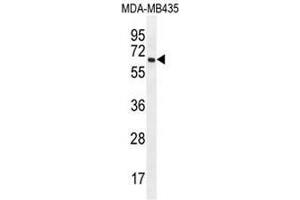 PRAMEF20 Antibody (C-term) western blot analysis in MDA-MB435 cell line lysates (35µg/lane). (PRAMEF20 Antikörper  (C-Term))
