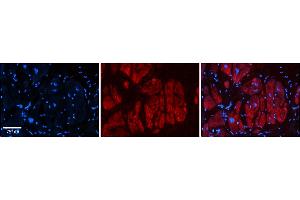 Rabbit Anti-Zfr Antibody  Catalog Number: ARP39226_P050 Formalin Fixed Paraffin Embedded Tissue: Human Adult heart  Observed Staining: Cytoplasmic Primary Antibody Concentration: 1:600 Secondary Antibody: Donkey anti-Rabbit-Cy2/3 Secondary Antibody Concentration: 1:200 Magnification: 20X Exposure Time: 0. (ZFR Antikörper  (N-Term))