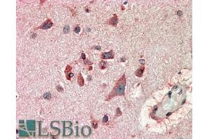 Immunohistochemistry (IHC) image for anti-F-Box and Leucine-Rich Repeat Protein 2 (FBXL2) (N-Term) antibody (ABIN185053)