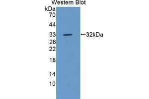 Western blot analysis of the recombinant protein. (ROS1 Antikörper  (AA 1937-2210))