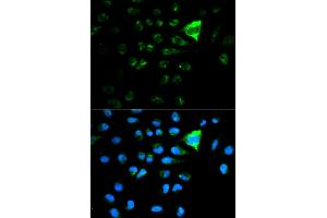 Immunofluorescence analysis of MCF-7 cells using CDKN1A antibody. (p21 Antikörper)